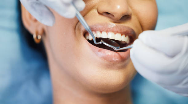 Best Emergency Treatment for Dental Infections or Abscesses in Rosemont, PA