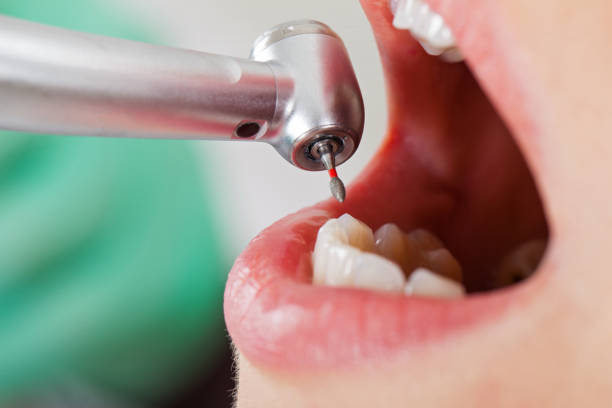 Best Pediatric Emergency Dentist in Rosemont, PA
